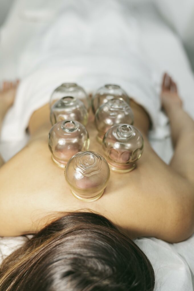 séance de ventouses ou cupping